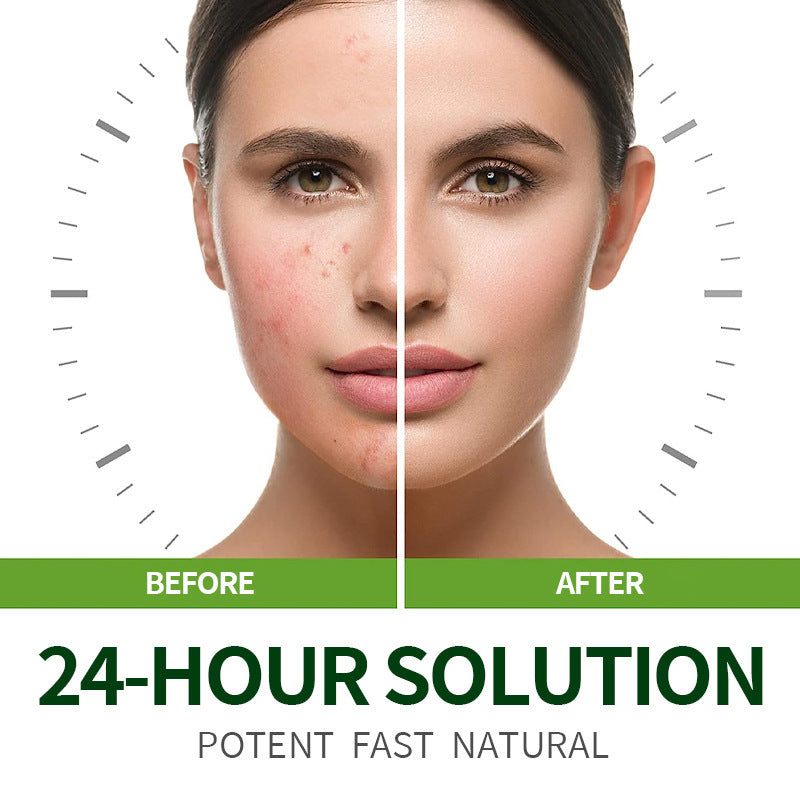 Tea Tree Moisturizing Cream Repair