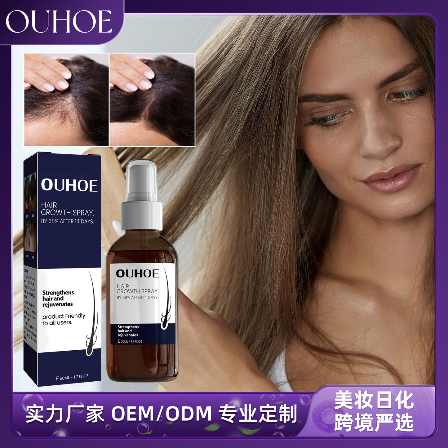 OUHOE Hair Growth Spray Strengthens dense hair, moisturizes scalp, and nourishes damaged hair. Hair Growth Spray