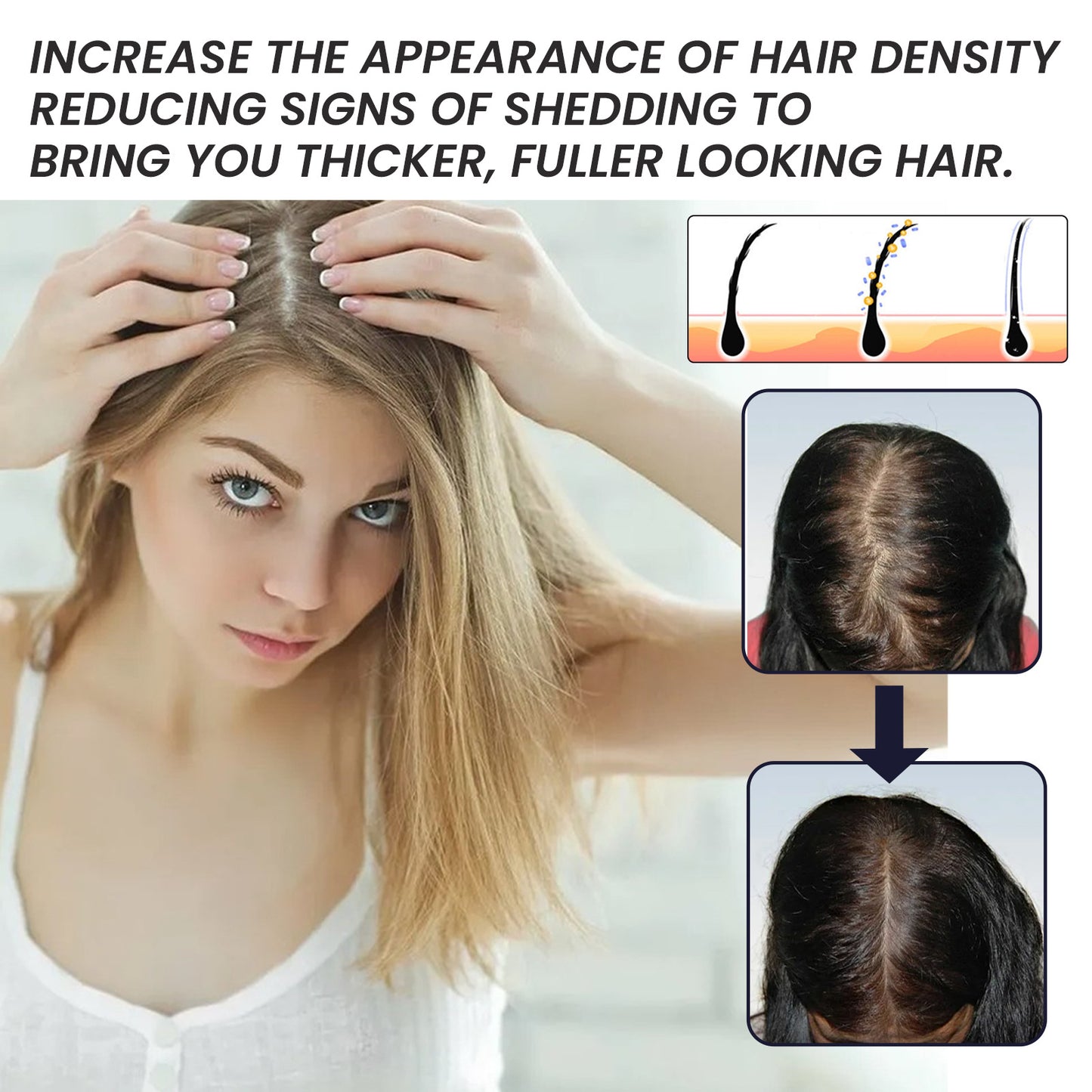 خلاصة الشعر الكثيفة بالبيوتين من OUHOE تعمل على ترطيب جذور الشعر، وإصلاح الشعر الكثيف من خلال إصلاح خط الشعر، وتقوية وتقوية خلاصة الشعر.