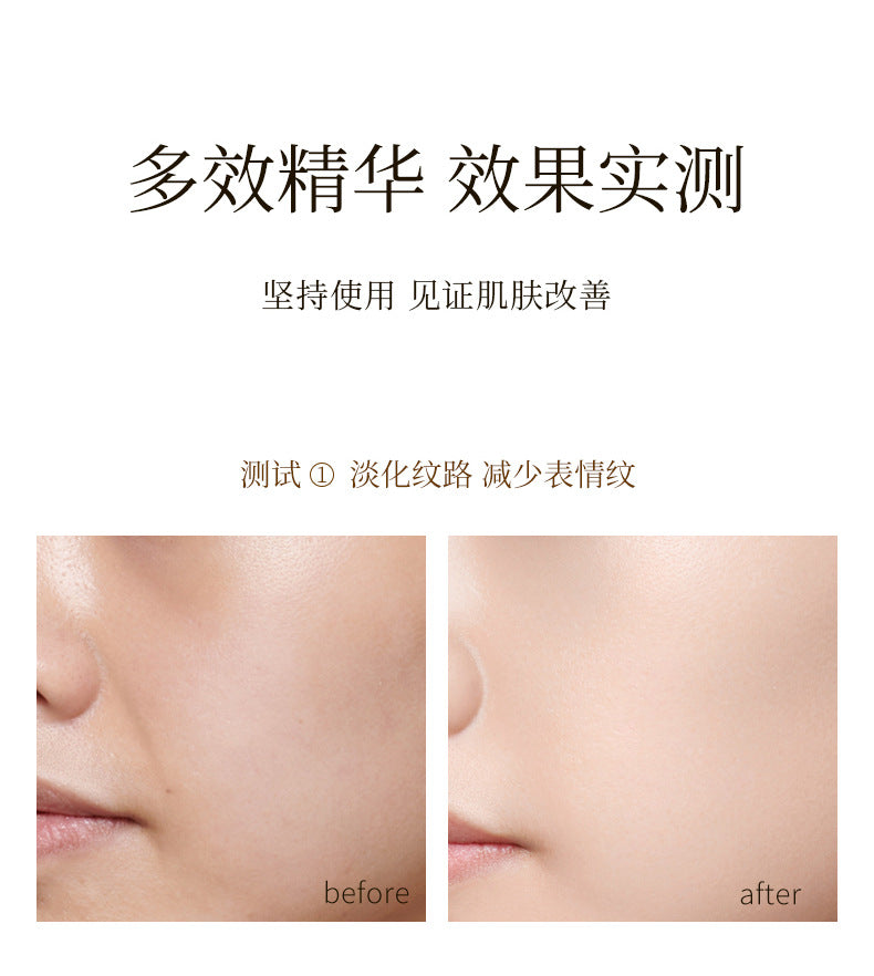 مجموعة HIH Bouncy Gold Protein Peptide Set Box Essence Lifting, Fading, Stretching and Fine Grain Protein Line Carving Skin Care Set Box