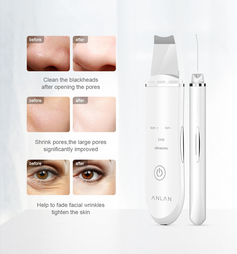 Ultrasonic Skin Scrubber Deep Face Cleaning Machine Peeling Shovel Facial Pore Cleaner Face Skin Scrubber Lift Machine