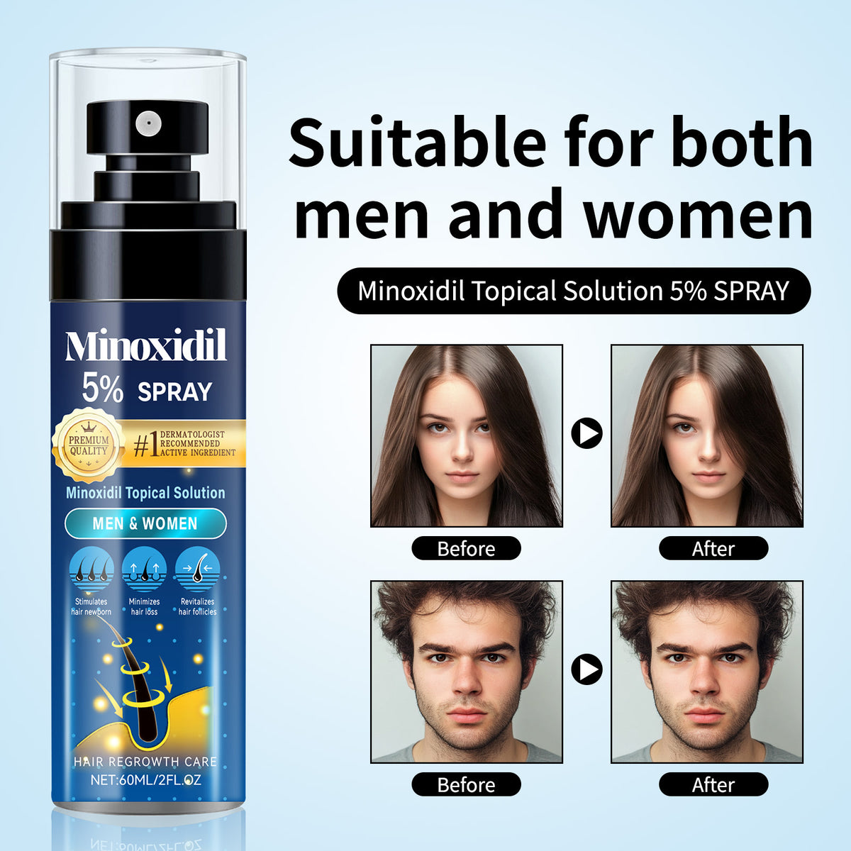 Relieve Hair Thinning And Moisturizing Hair Care Spray