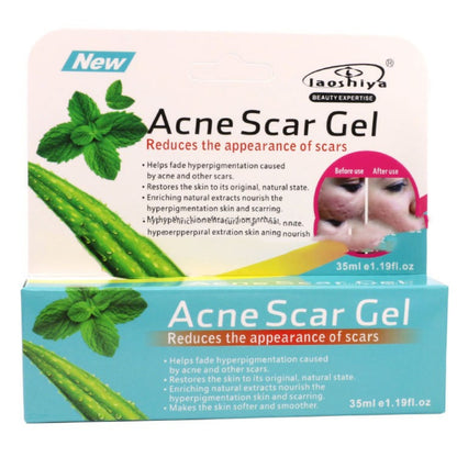 Repair And Acne Removing Cream 35ml