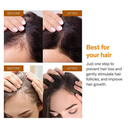 Cross-border supply of fobap stimulate maw hair growth hair care essential oil hair growth liquid