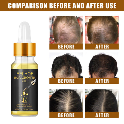 EELHOE Dense Hair Essence Strong and Strong Hair Care Essential Oil Soft and Moisturizing Hair Thick Hair Nutrient Liquid