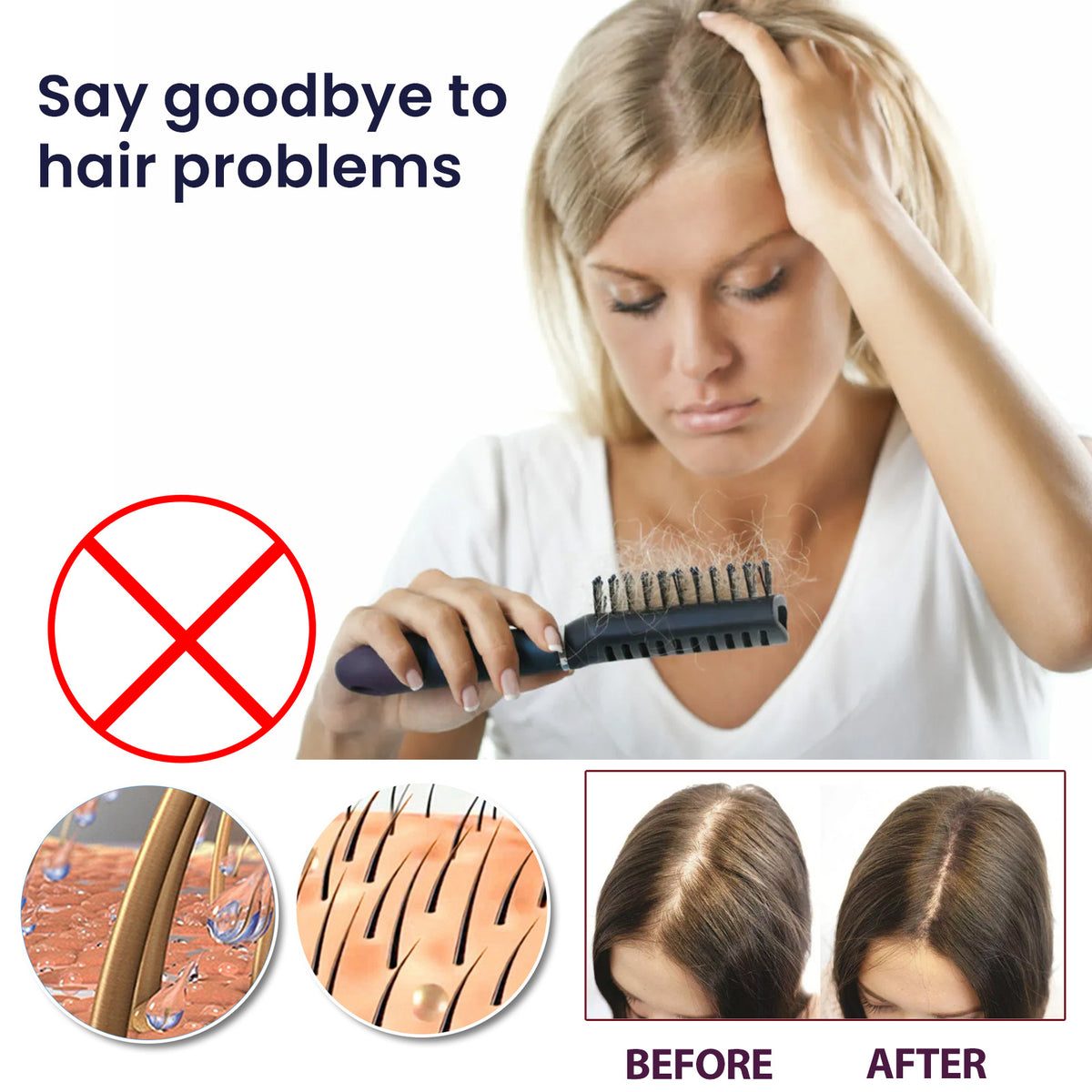 OUHOE Hair Growth Spray Strengthens dense hair, moisturizes scalp, and nourishes damaged hair. Hair Growth Spray