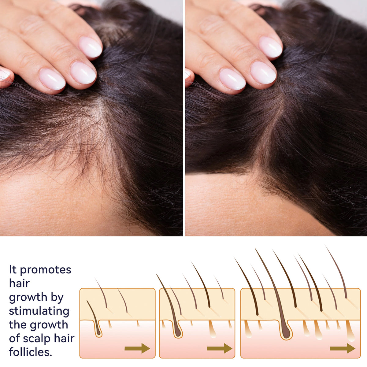 OUHOE Hair Growth Spray Strengthens dense hair, moisturizes scalp, and nourishes damaged hair. Hair Growth Spray